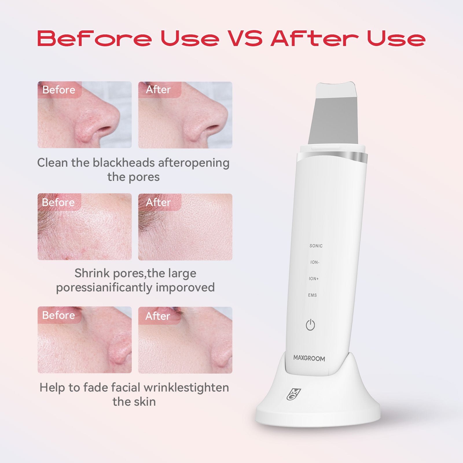 MAXGROOM M-169 ultragarsinis kavitacijos ir LED šviesos terapija - balta -- Uncategorized